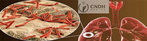 Día Mundial de la Tuberculosis, 2022: por la cobertura sanitaria universal